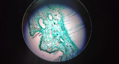 Kula ukazana w powiększeniu mikroskopowym. Na białym tle widać porowaty, zielony obszar.